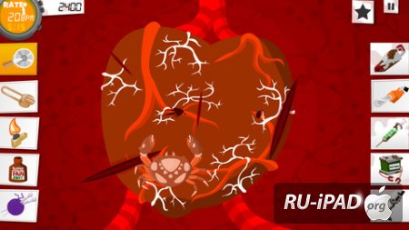 Amateur Surgeon 2 [2.3] [ipa/iPhone/iPod Touch/iPad]